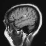 tac-craneal imagen tumoral-Conozca la Unidad de Neurocirugia RGS-