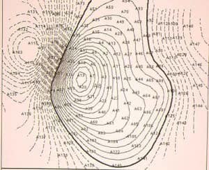 magnetoencefalografia Informacion al paciente - temas generales - exploración neurológica - Magnetoencefalografía