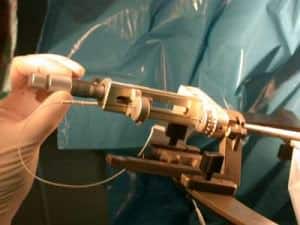 15-micromanipulador-y-microelectrodo-en-arco-guia-estereotaxica