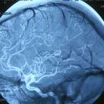 angiografia-cerebral docencia-pregraduados-facultad de medicina uam- angiografia-cerebral
