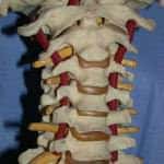 columna-cervical--arterias-vertebrales docencia-pregraduados-facultad de medicina uam- columna-cervical--arterias-vertebrales