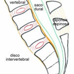esquema-disco-intervertebral Informacion al paciente-patologia de la columna vertebral-inestabilidad lumbar-esquema-disco-intervertebral