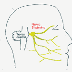 esquema-nervio-trigemino2 Información al paciente-neurocirugia funcional-neuralgia-del-trigemino-esquema-nervio-trigemino