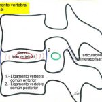 esquema-segmento-vertebral-normal Informacion al paciente-patologia de la columna vertebral-inestabilidad lumbar-esquema-segmento-vertebral-normal