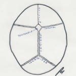 esquema-suturas-normales docencia-pregraduados-facultad de medicina uam- esquema-suturas-normales