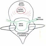 esquema-vertebral-saco-dural Informacion al paciente-patologia de la columna vertebral-inestabilidad lumbar-esquema-vertebral-saco-dural
