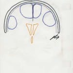 esquemas-distribucion-meningiomas-C docencia-pregraduados-facultad de medicina uam- esquemas-distribucion-meningiomas-C