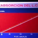grafica-reabsorcion-lcr docencia-pregraduados-facultad de medicina uam- grafica-reabsorcion-lcr