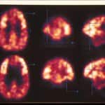 pet-cerebral docencia-pregraduados-facultad de medicina uam- pet-cerebral