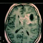 rm-cerebral docencia-pregraduados-facultad de medicina uam- rm-cerebral