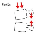 rotura-ligamentos-por flexion docencia-pregraduados-facultad de medicina uam- sección medular- rotura-ligamentos-por flexion