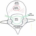 esquema-vertebra-en-saco-dural Informacion al paciente-patologia de columna vertebral-hernia discal lumbar-esquema-vertebra-en-saco-dural
