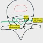 estenosis-de-canal-congenita Informacion al paciente-patologia de columna vertebral-estenosis lumbar-estenosis-de-canal-congenita