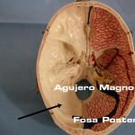 interior-de-un-craneo Informacion al paciente-patologia craneoencefalica-meningiomas-convexidad-cerebelosa-interior-de-un-craneo