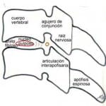 vista-lateral-vertebras-cervicales información al paciente-patologia columna vertebral-hernia fiscal cervical-vista-lateral-vertebras-cervicales