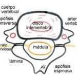 vista-superior-vertebral-cervical información al paciente-patologia columna vertebral-hernia fiscal cervical-vista-superior-vertebral-cervical