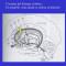 Casos clínico de neurocirugia funcional Dolor-cronico-cingulotomia-bilateral-estereotaxica-lateral