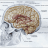 Casos clinicos de neurocirugia funcional - hipertension-endocraneana