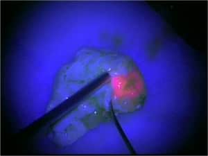 cirugia-epilepsia-microscopio-fluorescente-m